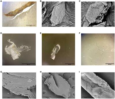 Microplastics in feed cause sublethal changes in the intestinal microbiota and a non-specific immune response indicator of the freshwater crayfish Procambarus clarkii (Decapoda: Cambaridae)